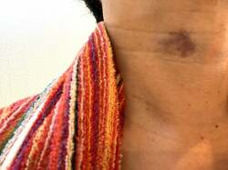  東MAX、自身の体に出ている原因不明の症状を報告「本当に病気のサインかも」 