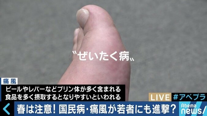 若者・女性の患者も増加！国民病“痛風”を予防するには？ 1枚目