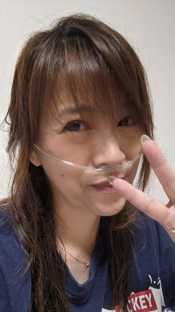 善本考香さん、トイレで倒れてしまい大騒動「おケツ丸出し搬送」  1枚目