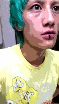 精巣がん公表のNosuke、1年続いた異変振り返り「僕も誰かを救うきっかけになれればと」