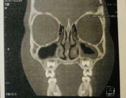  ココリコ・遠藤の妻、大学病院でCT検査を受けて判明した次男の病名「治療頑張って」「絶対に大丈夫」の声 