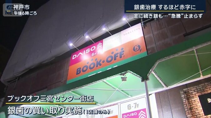 銀歯の買い取り実施