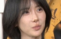 整形総額1300万円の美女、骨切りダウンタイムの苦しみ明かす「毎朝息ができなくて起きる」