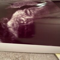 桃『27週の妊婦健診で気付いたこと』