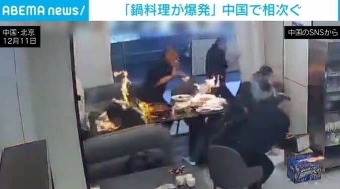 1人が髪の毛を焦がす被害