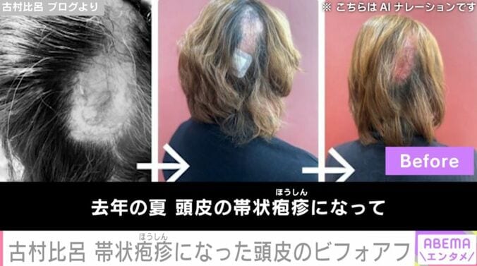抜け落ちた髪の毛のビフォー