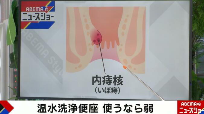 正常じゃないお尻の状態（イラスト）