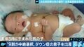 ”9割が中絶を選択” 出生前診断を受け、「命の選択」を迫られた夫婦の苦悩