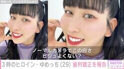 整形公表が話題・3時のヒロインゆめっち、歯列矯正していたことを報告「出っ歯でお口が閉じないのを治したくて」