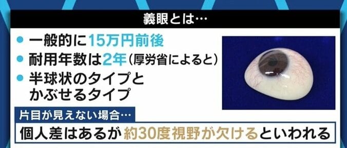 「義眼で人生が変わった」「片目が見えるじゃないかと言われ、障害者として認めてもらえない」…当事者たちに聞いた「片目失明」のリアル 16枚目