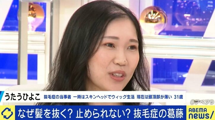 中学受験のストレスで発症してしまう小学生も…「気付いたら周りが頭髪だらけに…」やめたいのにやめられない“抜毛症”に悩み続ける女性