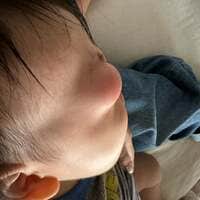 桃『こんなに目が腫れた人、初めて見たよ…！』