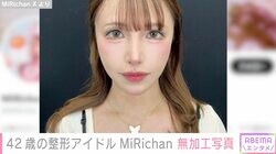 1000万円以上の整形公表“42歳の現役アイドル”MiRichan「完全無加工」の写真をファン大絶賛「美魔女」「20代にしか見えない」