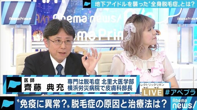 「頭が丸くても続けたい」…全身脱毛症アイドル、告白の裏にファンの後押しも 9枚目