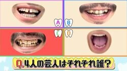 キングオブコント王者の“歯”にAマッソ加納「地獄の入口ですか!?」