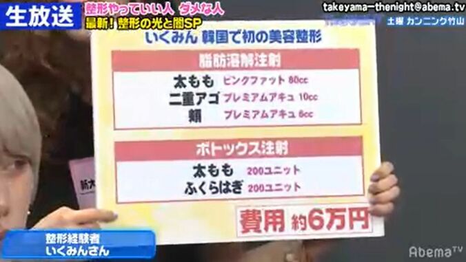 格安？ 危険？ 経験者が語る韓国と日本の整形事情 3枚目