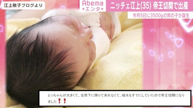 ニッチェ江上、第1子の出産は帝王切開「全然下に降りて来れなくて」 1枚目