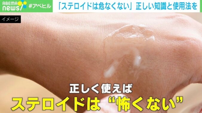ステロイドは“怖くない” 専門医が語る正しい知識と使用法「副作用を十分知ったうえで必要なタイミングで投与」 1枚目