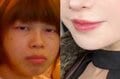 上司に「横顔ゴリラに似てるな」と言われ整形を決意…30代セクシー女優のビフォーアフターにヒコロヒーら衝撃「えぇっ…」
