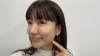 桃(39)「私のあご 出すぎてない?」 5年前に韓国の美容クリニックで施術を受ける