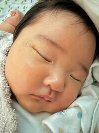 内山琴『まだ目ヤニ目継続中〜』