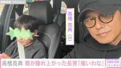 高橋克典、14歳長男の腫れた頬の写真公開「小さかった時みたいなほっぺたになって、ちょっと懐かしかった」