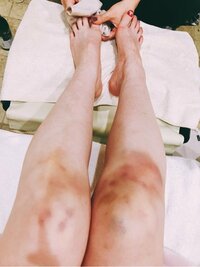 中川翔子『アザさん』