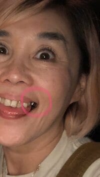 野沢直子『歯抜け対策なしで。笑笑』