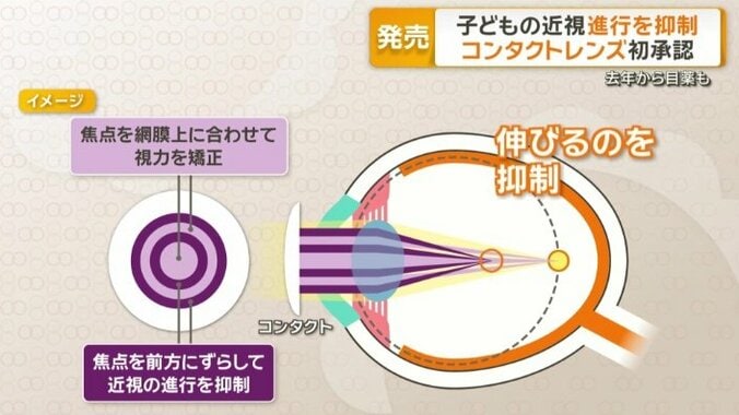 目の奥行きが伸びるのを抑えることができる