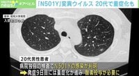 【映像】新型コロナ「N501Y」 20代でも重症化