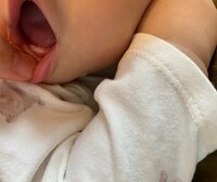 光上せあら『同じ遺伝子の2人の発達の差』