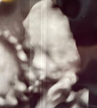 だいたひかる『そっくり!?エコー写真』