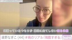 摂食障害を公表の遠野なぎこ「これ以上やせたくない」“病のリアル”を明かす
