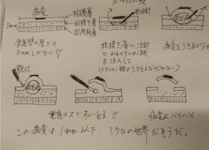  秋野暢子、医師から説明された食道下部にある小さながん「前回肉眼では見えなかった」  1枚目