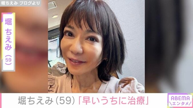 【写真・画像】「侮れない」堀ちえみ（59）、臀部の治療を受けたことを報告　1枚目