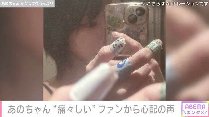 あのちゃん Instagramより