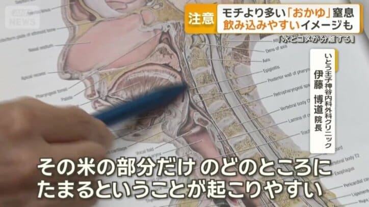 「水分量が多いので水と米が分離しやすい」