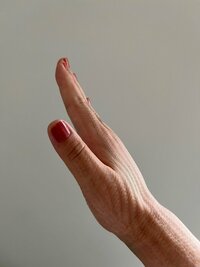 だいたひかる『術後8日たった様子』