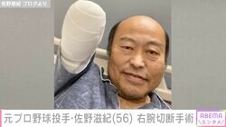 元プロ野球投手・佐野慈紀氏、右腕切断後の写真投稿「ぬいぐるみみたい。。。そんなええもんちゃうやろ！」