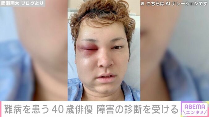 “10万人に1人”の難病を患う40歳俳優、 新たな障害の診断を受けたことを報告「本当に負のループ生活を生きています」 4枚目