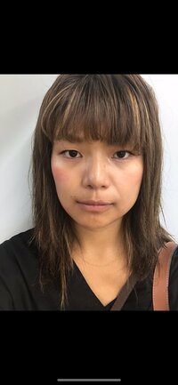 クロ『整形顔』