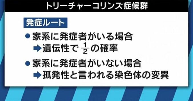 「ワンダー 君は太陽」で描かれたトリーチャーコリンズ症候群　“当事者”石田祐貴さんが視線を浴びながらも街を歩く理由 2枚目