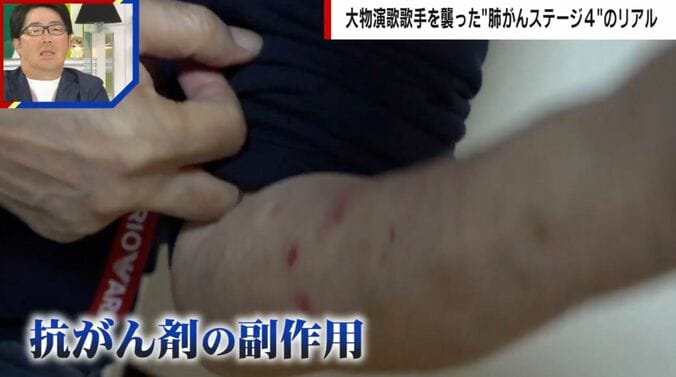 副作用に苦しむ山川豊