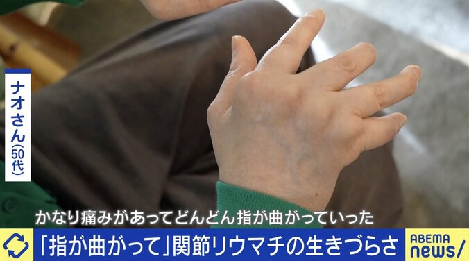 関節リウマチとは