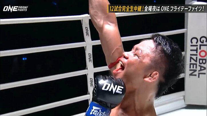 「顔面壊れるぞ」視聴者“ドン引き”からの大逆転KO劇！ 衝撃の“前のめり”決着に「曙ダウンだ」ファン大興奮