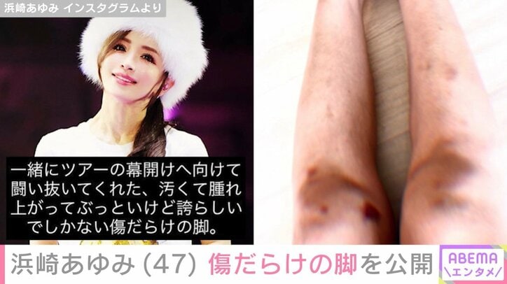 酷使した自身の足