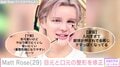 Matt Rose、目元と口元の整形を修正「慎重に打つ場所と打つ量を考えた方がいい」