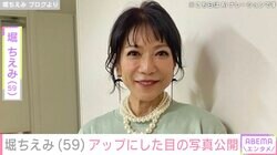 “目の施術後の姿”が話題・堀ちえみ（59）、アップにした目の写真公開「メイクさんが声出して驚いた」