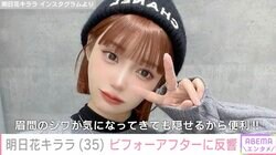 明日花キララ、イメチェンした近影が話題に「一瞬あのちゃんに見えました」