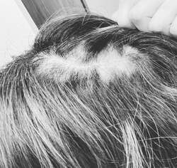  ノンスタ石田の妻、病院で診断され先の見えない絶望感に涙「悔しくて悲しくて」 